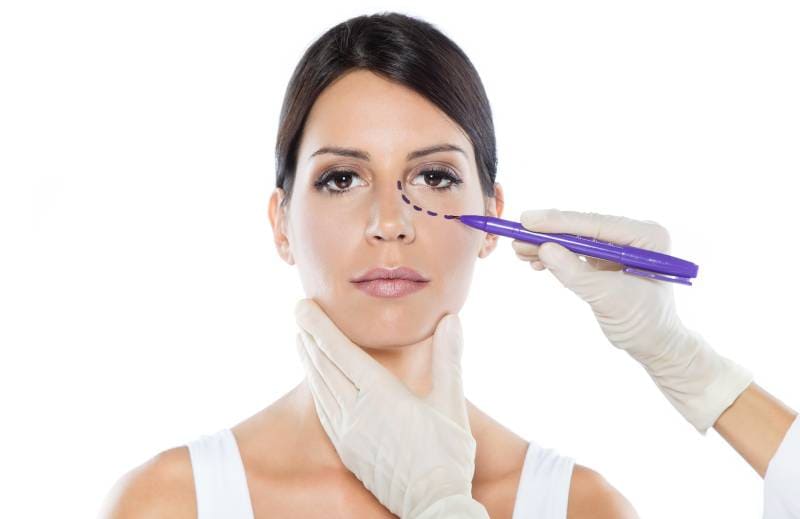 Blefaroplastia ofrecida por él Dr. Javier Sánchez - Especialista en Cirugía Plástica Estética